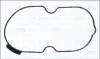 Кришкка ременя ГРМ MAN TGE AUDI A1, A3, Q2, Q3 SEAT ARONA, ATECA, IBIZA V, LEON, LEON SC, LEON ST, TARRACO, TOLEDO IV SKODA KAMIQ, KAROQ, KODIAQ I, KODIAQ II, OCTAVIA III 1.6D/2.0D 08.12 AJUSA (01447600) зображення 1