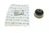 Сайлентблок важеля (переднього/знизу/ззаду) Toyota Yaris 99-05 30146100010