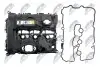 Кришка клапанів NTY (BPZ-BM-014) зображення 4