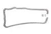 Фото Комплект ланцюга ГРМ MB Sprinter 2.2CDI OM651 09- (+2 шестерні) TRUCKTEC (0212241) зображення 14